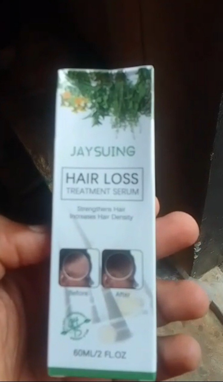 JAYSUING : Une Chevelure Plus Forte, Une Confiance Retrouvée