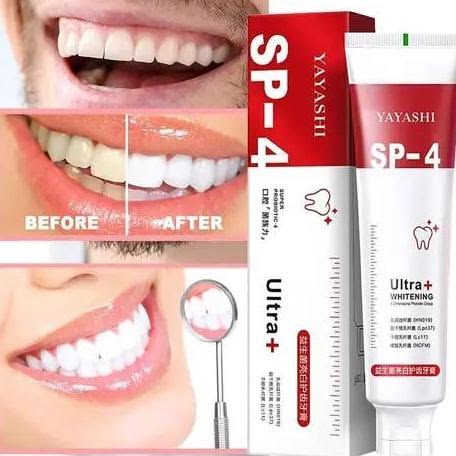 SP-6: Un Sourire Plus Lumineux, Plus de Confiance